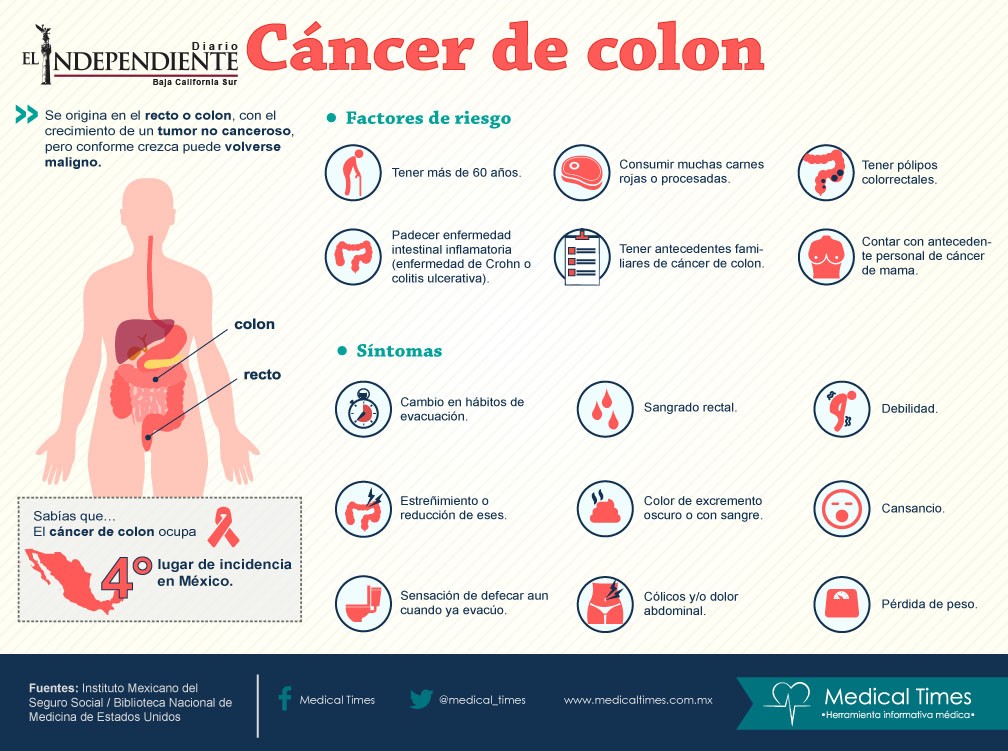 Cancer de colon