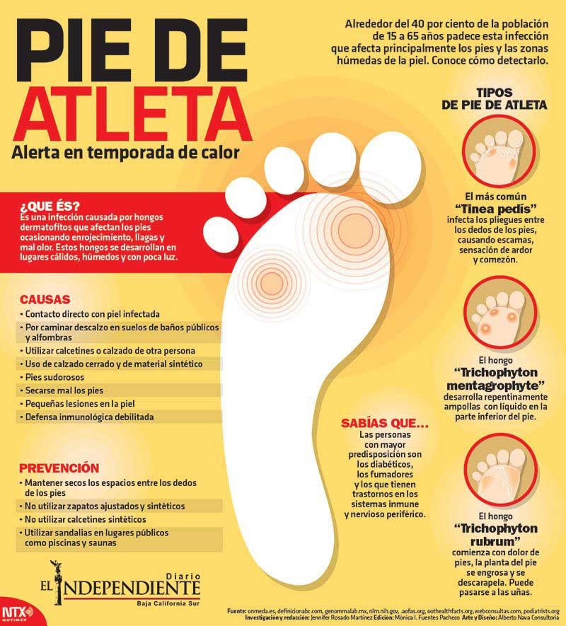 PIE DE ATLETA