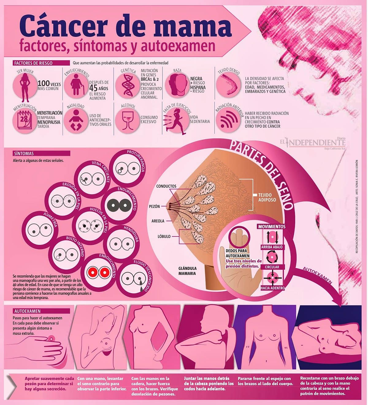 Cáncer de mama