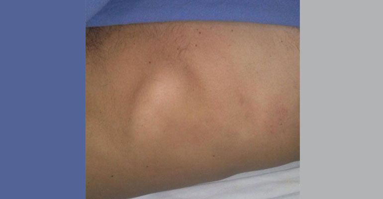 Redes sociales libres de expresión, no pueden ser sancionadas por el IEE