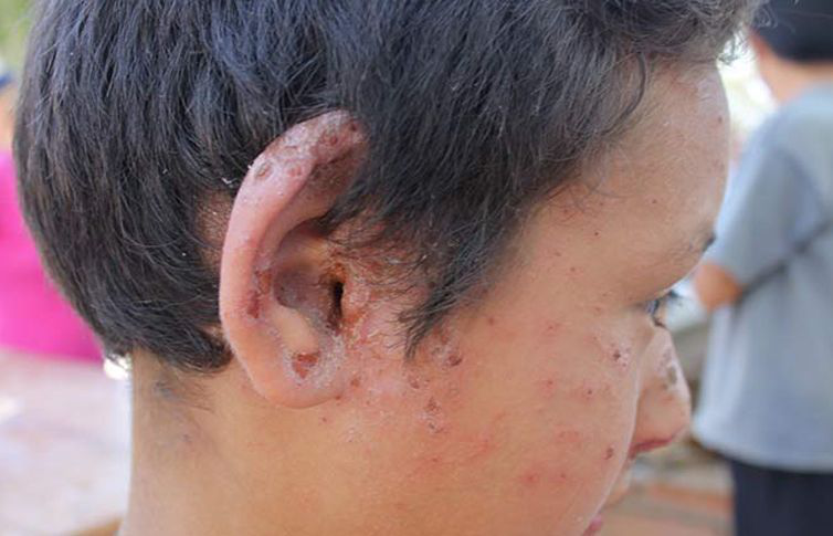 Grupo México afectó a 75 niños y 49 ancianos por derrame en Río Sonora