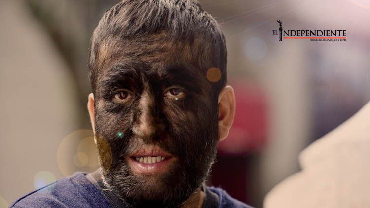 Chuy, el 'hombre lobo' mexicano comparte su historia