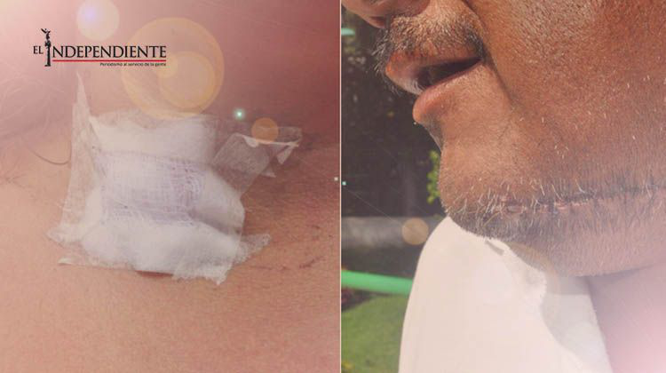 Capturan a 'La Degolladora' en Chimalhuacán