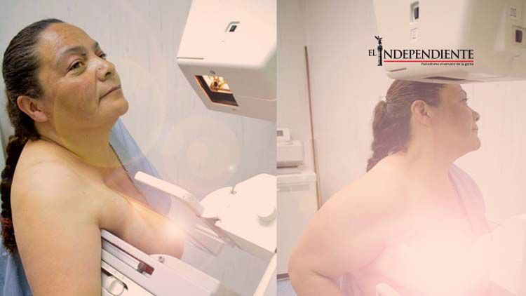 Brindarán mejor atención y tratamientos de vanguardia a mujeres con cáncer de mama en el ISSSTE