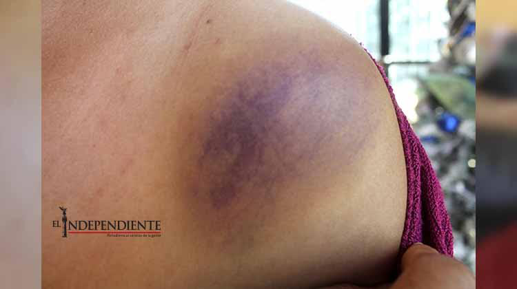 Vecina de Puerto Nuevo relata el asalto del que fue víctima