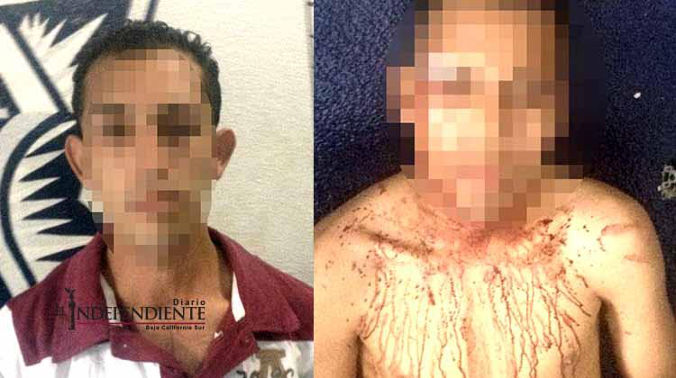 Pleito a machetazos en CSL deja un hombre herido y dos arrestados