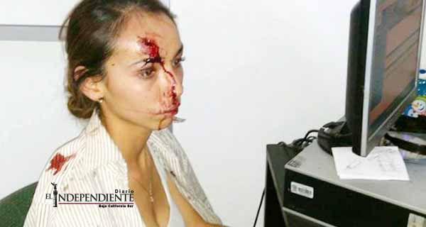 Investigan a exalcade que ordenó golpiza contra reportera