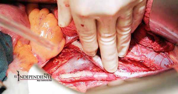 Logran generar músculos cardiacos a partir del prepucio