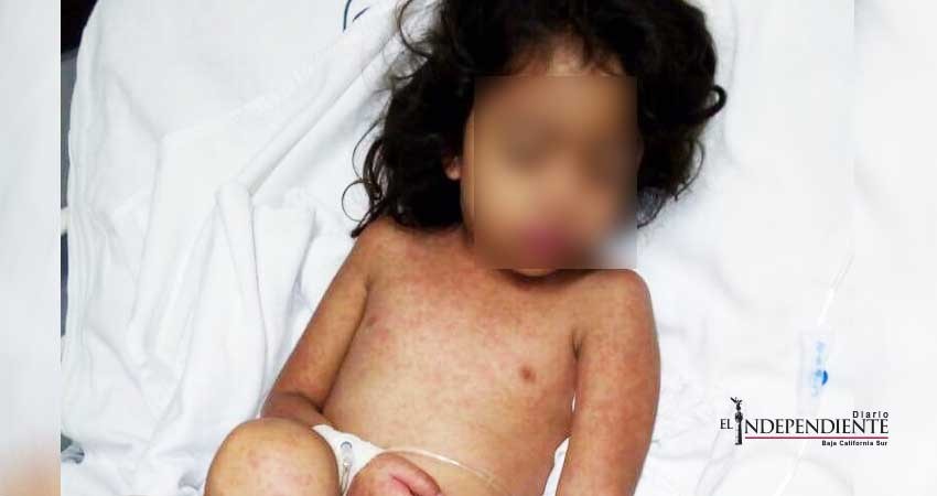 Niña que se salvó de morir ahogada en una alberca, ahora enfrenta una compleja  enfermedad