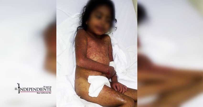 Tras denuncia en redes, trasladarán a Cd. Obregón a niña cabeña con infección