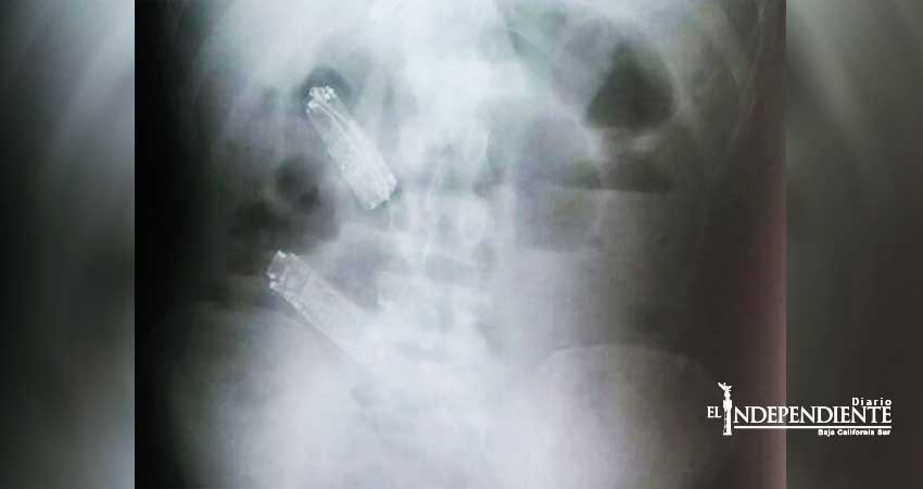 Preso muere una semana después de 'comerse' 3 celulares