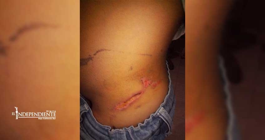 Sector Salud niega vacuna antirrábica a menor mordido por perro en el malecón