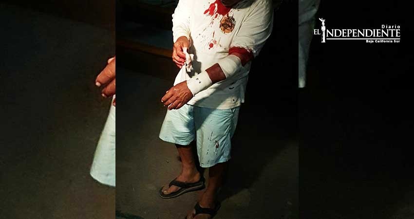 Se resiste a ser asaltado y lo agraden a machetazos