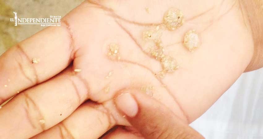 Sorprende lluvia acompañada de granizo en Los Cabos