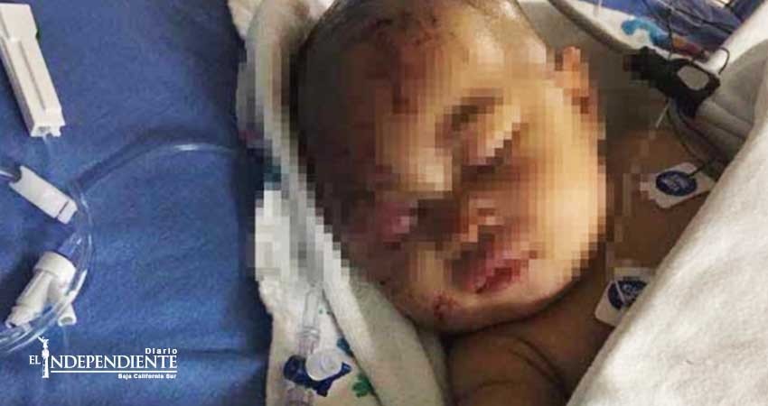 Mapache hiere de gravedad a bebé de cuatro meses en Filadelfia