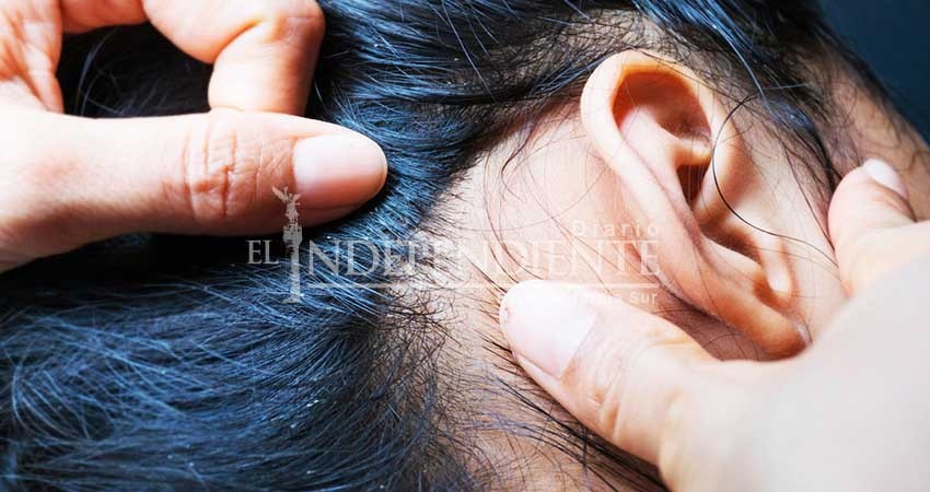Epidemiologia emite recomendaciones para disminuir presencia de piojos