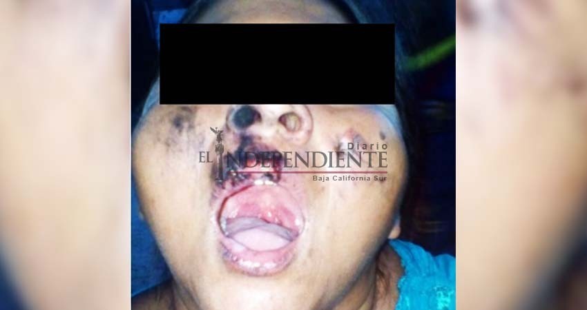 Cárcel para individuo que quemó con brasas a su esposa en invasión Santa Rosa, piden vecinos