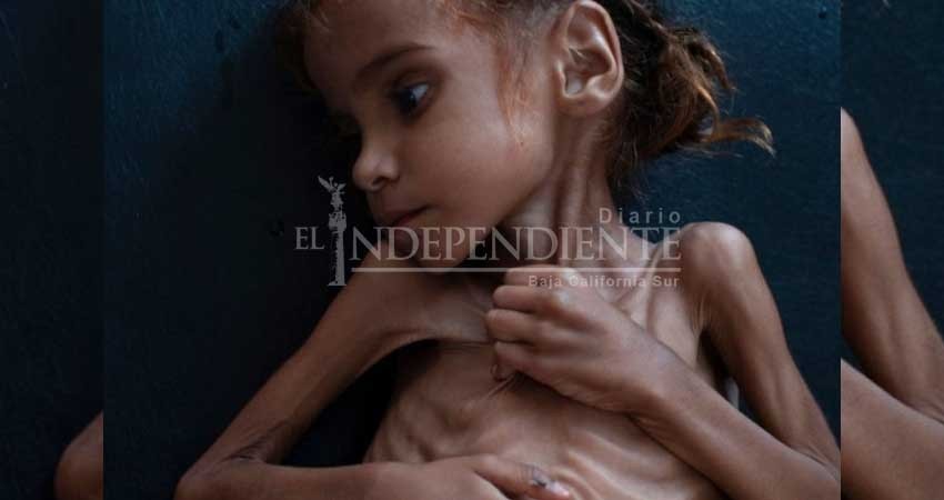Muere Amal Hussain, la niña que mostró la hambruna en Yemen
