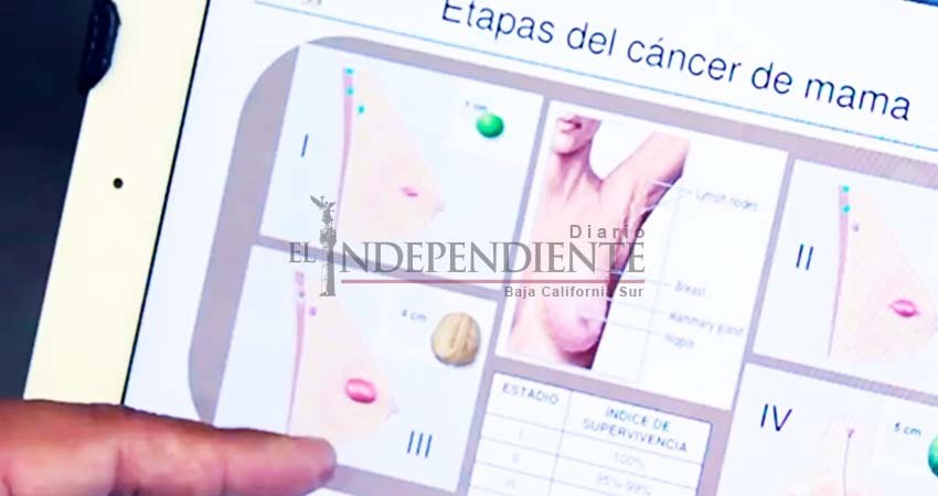 Científicos mexicanos detectan cáncer de mama con método de inmunodiagnóstico