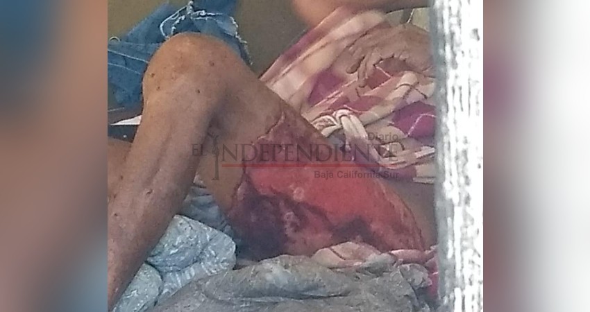 Le echaron aceite hirviendo en sus partes íntimas