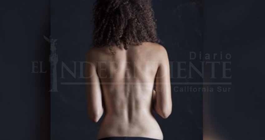 Instagram produce demanda de hoyuelos de Venus ficticios