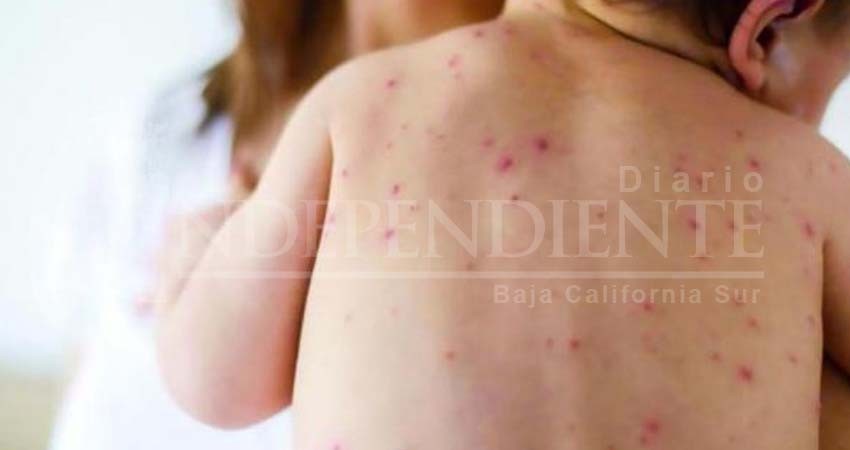 No hay reportes de sarampión en Los Cabos