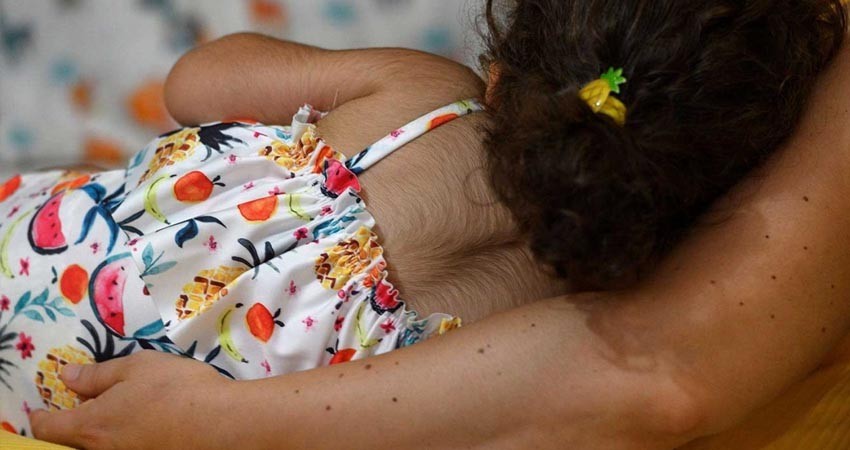 Error de farmacéutica causa bebés 'peludos'