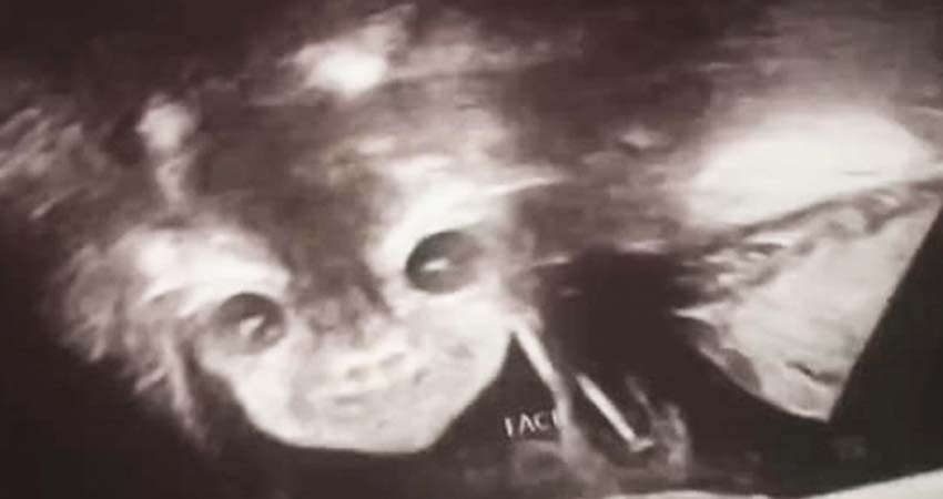 Captan ATERRADORAS imágenes durante un ultrasonido