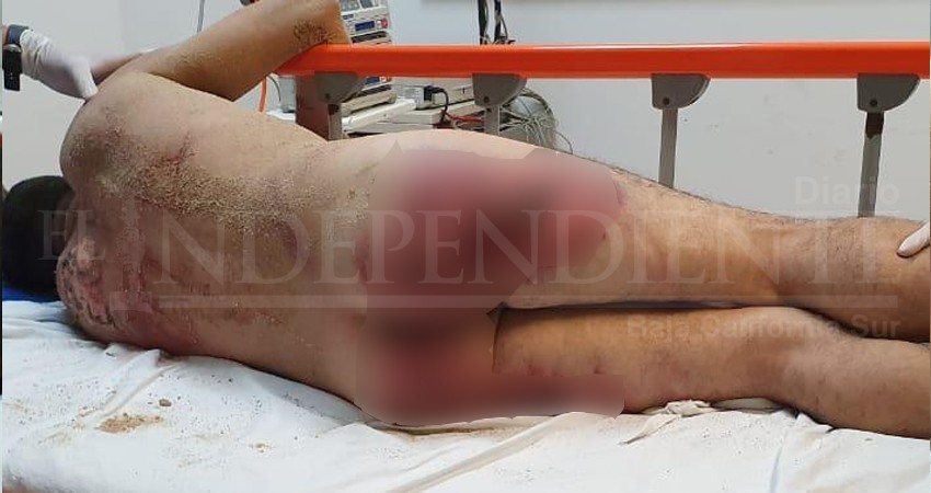 Torturan a presunto ladrón en colonia Chulavista de CSL