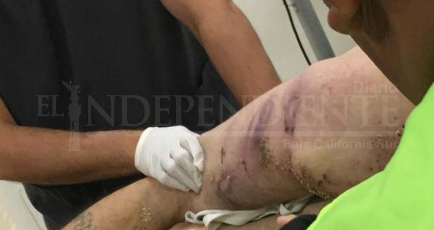 Encuentran dos personas golpeadas en Migriño; uno murió en el hospital