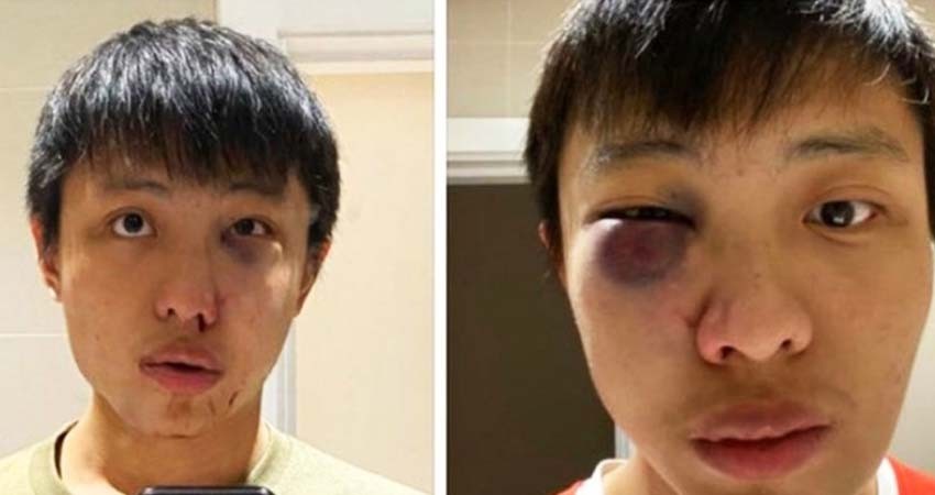 '¡No queremos tu coronavirus!' gritan; lo apalean brutalmente