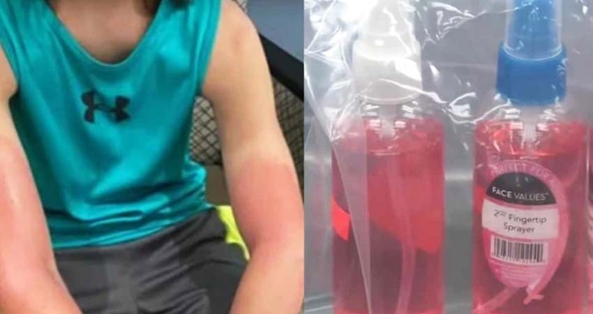 Vende gel antibacterial adulterado y niño termina en el hospital