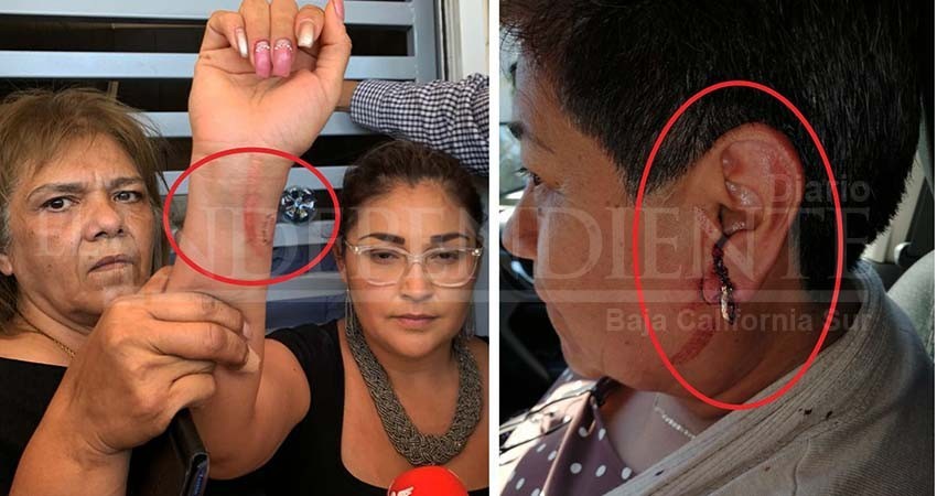 Entre golpes y mordidas, diputadas de BCS se disputan oficinas de Finanzas