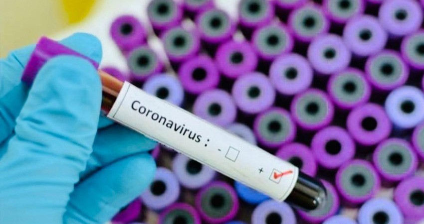 Detectan 2 casos más; ya son 8 infectados por COVID-19 en BCS