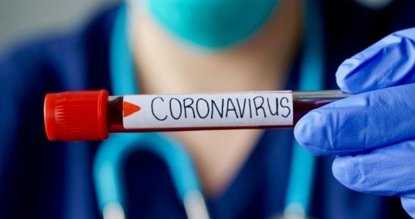 29 muertes y 1215 casos confirmados de COVID-19 en México