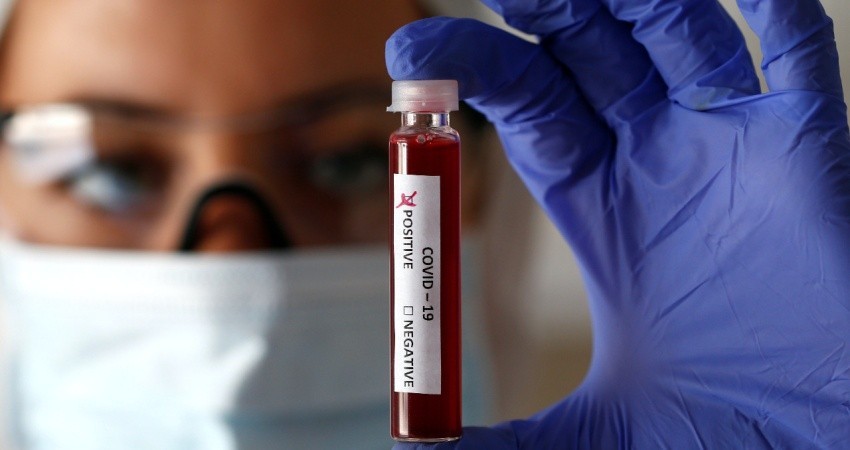 Aumenta a los 60 muertos por Covid-19; hay 1688 infectados en México