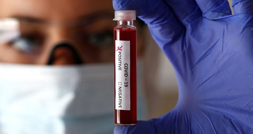 Suman 27 casos de COVID-19 en BCS; hay 82 casos sospechosos