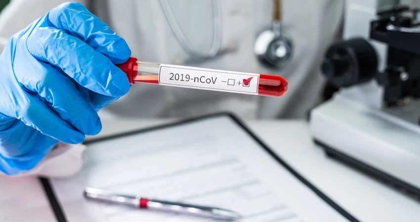 México alcanza la suma de 1,972 muertos y 20,739 infectados de COVID-19