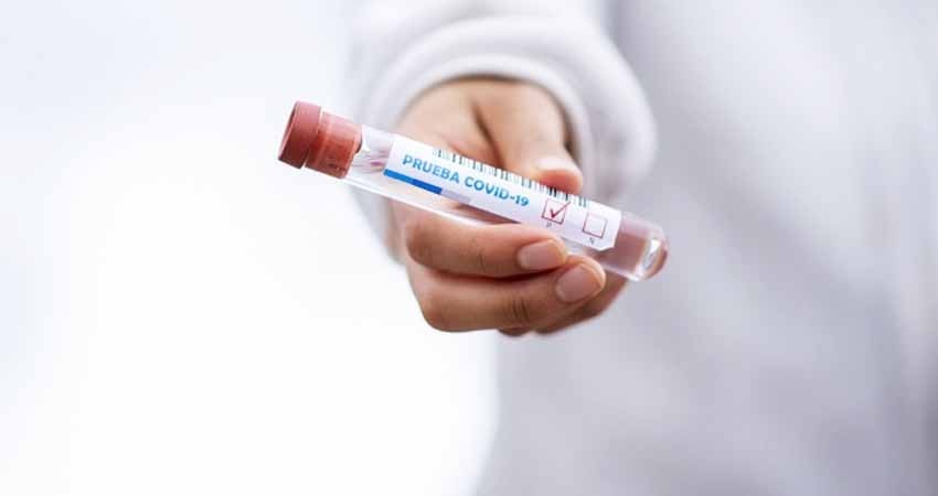 Alemania dona 100 mil pruebas de coronavirus a Perú