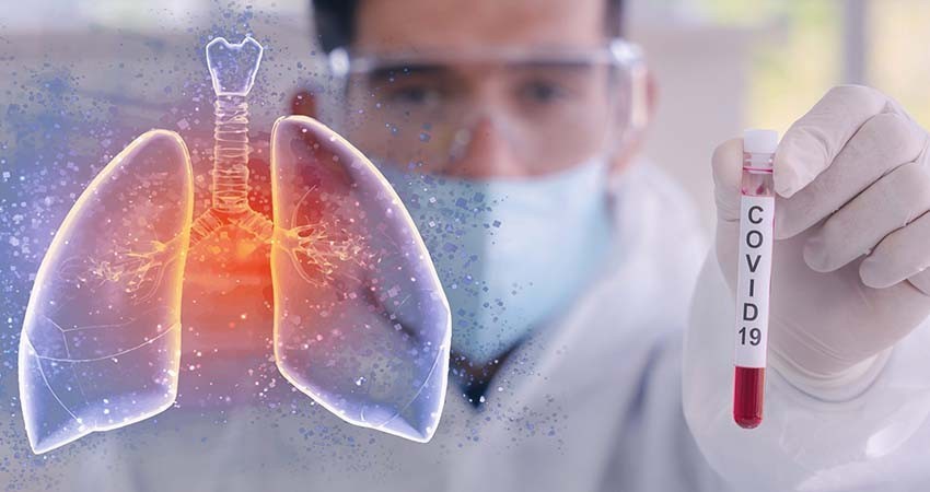 México llegó a 27,769 muertos y 23, 782 casos activos