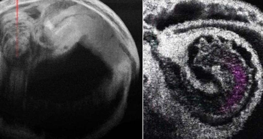 Checa la nueva forma de estudiar en 4D un corazón en desarrollo