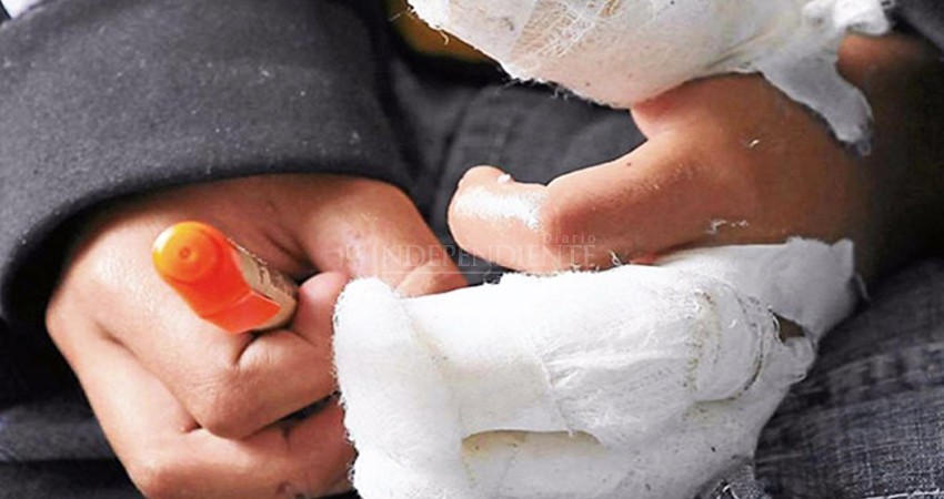 De nada sirvieron las restricciones: niño resulta herido por explosión de petardo en CSL