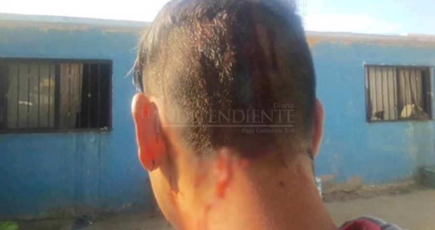 Le abrió la cabeza a su sobrino de un botellazo