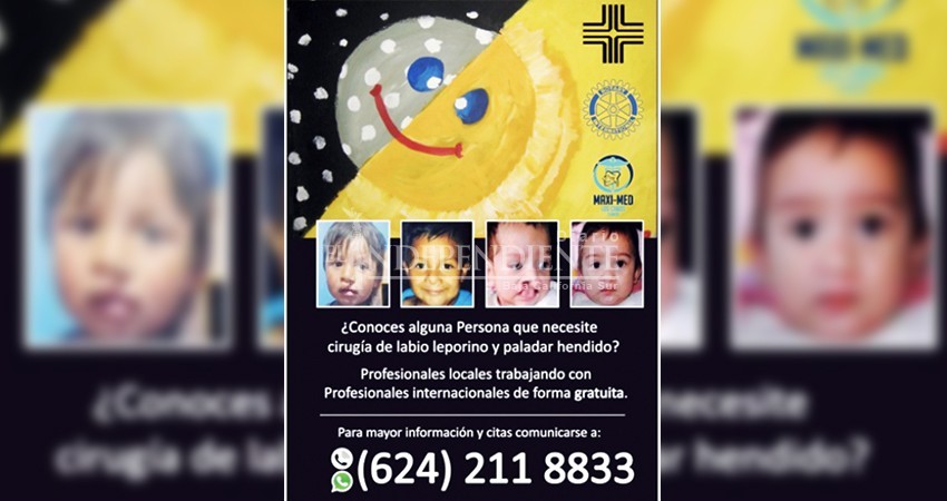 Inicia jornada de cirugías gratuitas para personas con paladar hendido y labio leporino