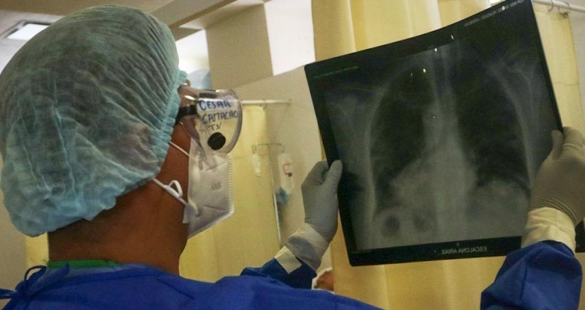 Especialistas del IMSS atienden secuelas pulmonares del Covid-19