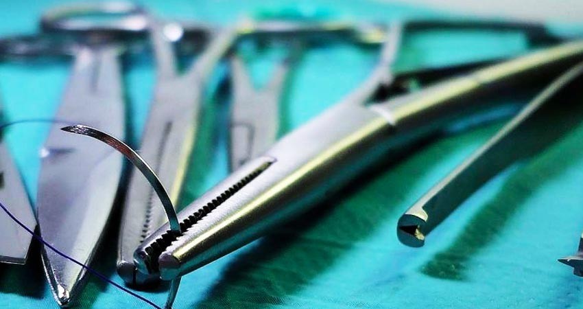 Mujer vivió 20 años con tijeras en su abdomen; médicos las olvidaron tras cirugía
