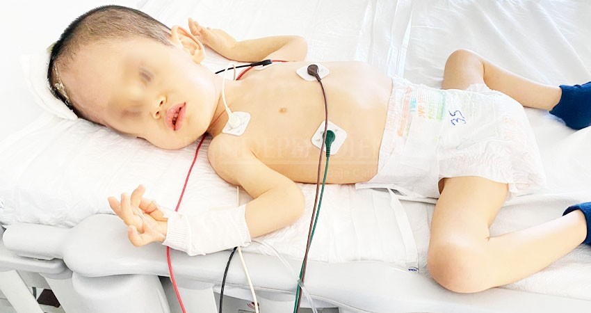 Exhiben al ISSSTE por no atender a Matías de 2 años, con hidrocefalia