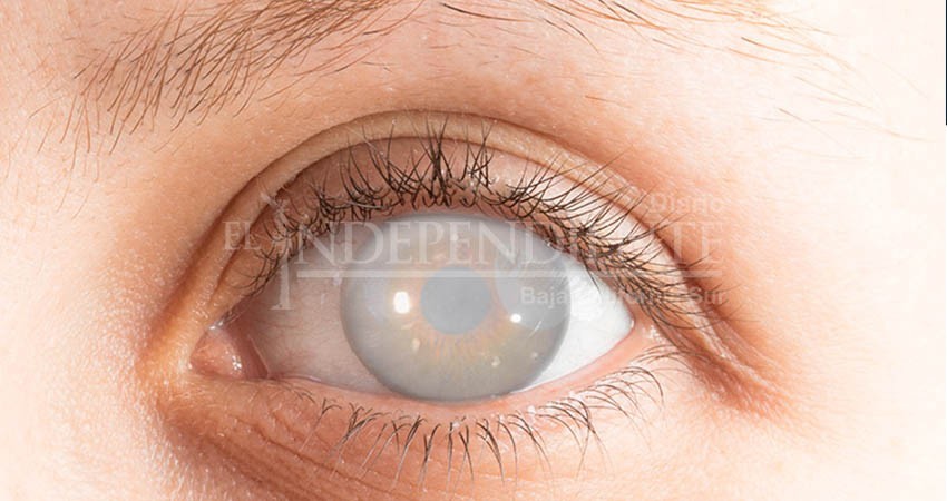 Clínica especialista ofrecerá cirugías oftalmológicas a bajo costo en BCS