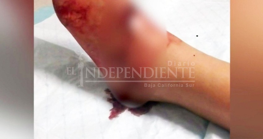 Se dispara en el pie elemento de Guardia Nacional en Loreto