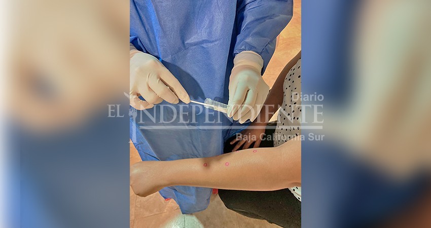 Mantiene SSA vigilancia epidemiológica en BCS por viruela símica